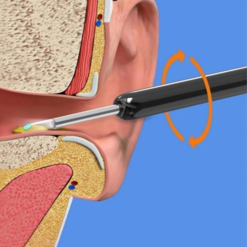 Ear Scope 2.0 Deluxe